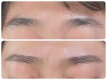 トータルビューティ ノイド(Noid)/メンズ美眉WAX脱毛