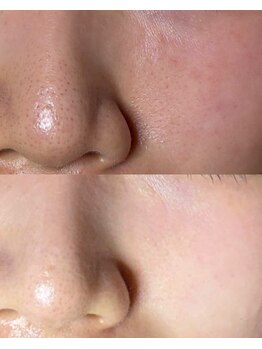 ソワ 吉塚店(soi)/知らない間に蓄積された汚れ