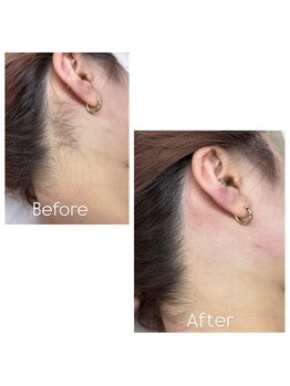 39 beauty salon.横浜関内【WAX脱毛/メンズ眉毛/水素吸入しながら】/後れ毛Wax