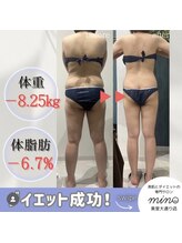 ミノ 美里大通り店(mino)/ダイエットパッケージ