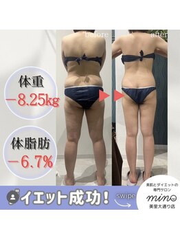 ミノ 美里大通り店(mino)/ダイエットパッケージ