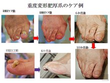 フットナース ケー(K)