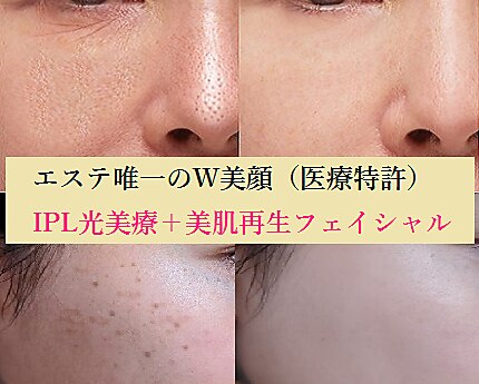 町田駅で毛穴ケアが人気のエステサロン｜ホットペッパービューティー