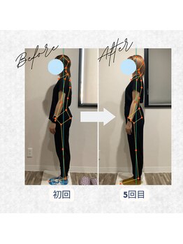 ラクリエ 姫路駅前院(La Creer)/お客様ビフォーアフター☆