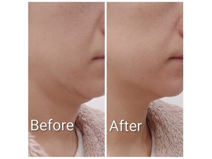 リエル(RiEL)の写真