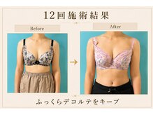 ネイト ワックス(Neit Wax)/定着したバストライン★