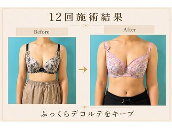 ネイト ワックス(Neit Wax)/定着したバストライン★