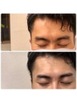 アイビー 神保町店(i.b)/眉【before⇒after】１０４