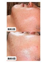 アルビーダ(RBDA)/これがホントの効果重視の脱毛！