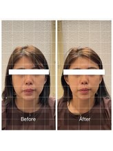 蒼月(aotsuki)/Before/After