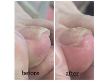イーネイル(e.nail)の雰囲気（[巻いた爪][厚みが出てしまった爪]などお悩みケア）