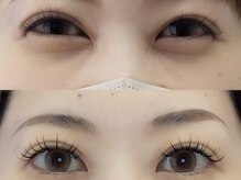 シャール(shall)/マツエク/LED/フラットラッシュ