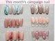 エイル ビューティー アルム(EIL beauty alm)の写真