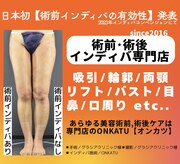 オンカツ(ONKATU)