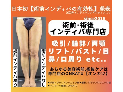 オンカツ(ONKATU)の写真