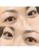 クレー(Klee)/ラッシュリフト