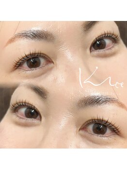 クレー(Klee)/ラッシュリフト