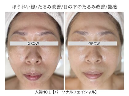 グロウ バイ フェイシャルデザイン アンド アイ(GROW)の写真