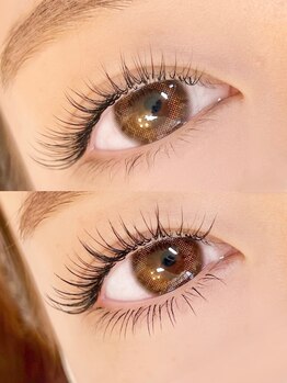 サロン ニー(ne)/小顔効果！