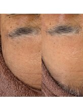 エス(S)/60代フェイシャルワックス