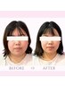 【フェイスラインすっきり・むくみ改善】小顔整体 初回体験 ¥9,000⇒