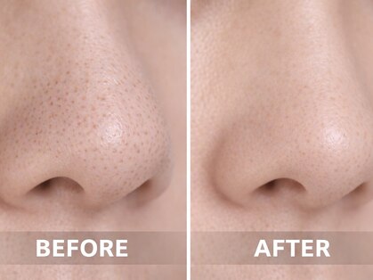 ロイ(Loy)の写真