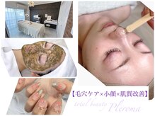 プレローマ(Pleroma)