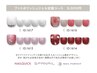 【フット】ケア+ポリッシュジェル定額アート¥11000 ジェルオフ無料