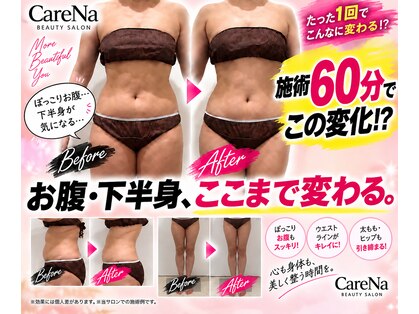 ケアナ 梅田(CareNa)の写真