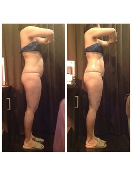 プラチナアース つくば店(Platinum earth)/痩身ビフォーアフター