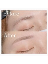 ルーム(ROOM)/Before After◎