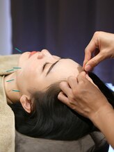 ハナレのハナレ(Hanareのハナレ)/美容鍼デビュー応援！