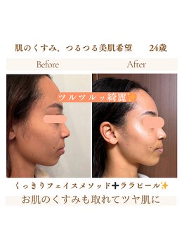 ルルドフォンテ(rurudo fonte.)/食いしばりもほぐしました