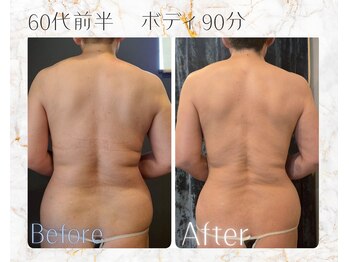 ベルココレ(Bellecocole)/60代でも変われる♪