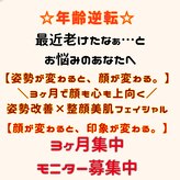 シェーン(Schon)
