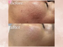 ハナチュチュ 矢場町店(Hanachuchu)/