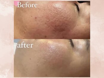 ハナチュチュ 矢場町店(Hanachuchu)/