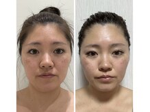 イーズ ららぽーと湘南平塚店(E/S)/