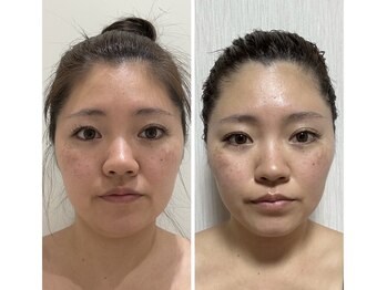 イーズ ららぽーと湘南平塚店(E/S)/