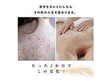 ラグラン銀座メディカルエステ 高輪ゲートウェイ店/イオン導入の120倍浸透プラズマ
