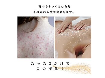 ラグラン銀座メディカルエステ 高輪ゲートウェイ店/イオン導入の120倍浸透プラズマ