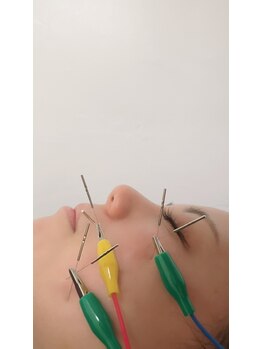 田中整骨鍼灸院 福岡白金院/美容鍼