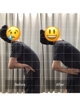 ナオル整体 目黒院(NAORU整体)/before/after(目黒/整体)