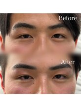 神戸のまゆげ屋さん 摂津本山 岡本店/【メンズ眉】眉毛WAX＋間引き
