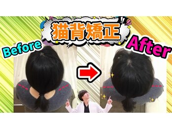 BTG整骨院 春日井院/猫背矯正ビフォーアフター