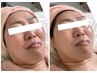 【圧倒的！小顔形成に】フェイスラインも頭も小さく！毛穴洗浄付きスペシャル