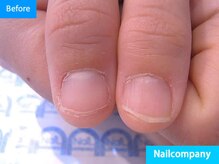 ネイルカンパニー/