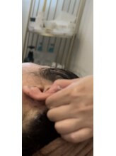 美温(mion)/耳までインディバ