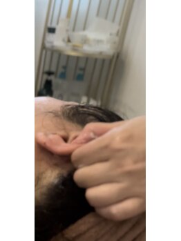 美温(mion)/耳までインディバ