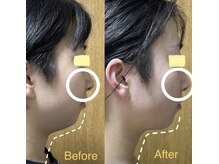 気になるフェイスラインのリフトアップや美白美肌効果大◎